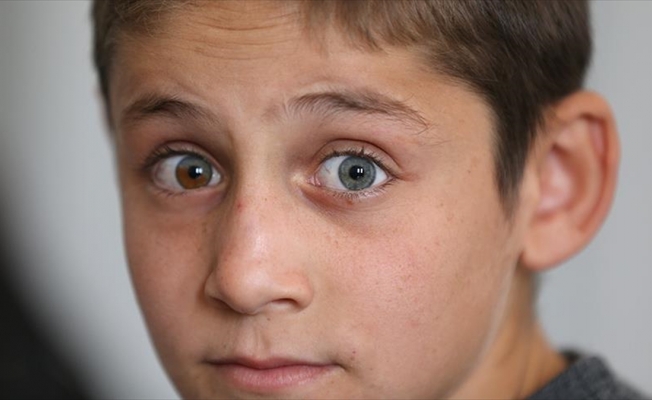 Bu gözler görenleri şaşırtıyor