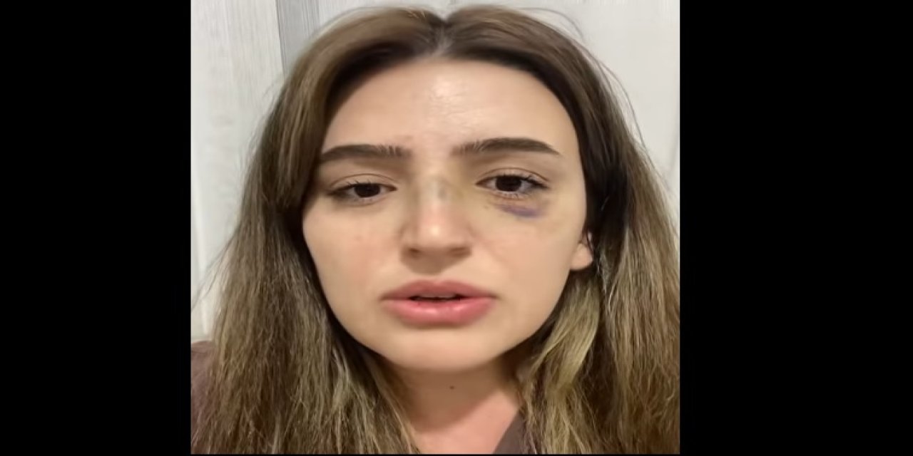 Eşi Tarafından Darp Edilen Öğretmen Yardım Talep Ediyor