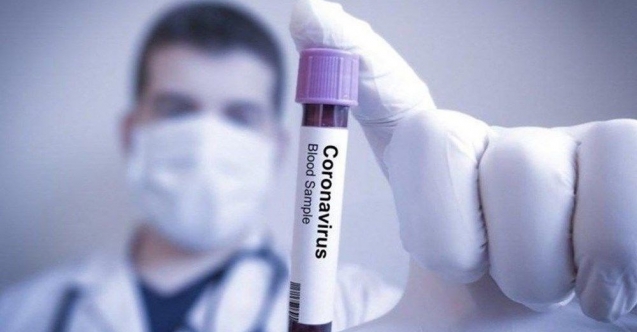17 soru-17 cevapla corona virüs COVİD 19