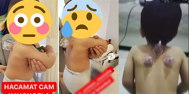 Sosyal medyadaki o görüntülere uzmanlardan uyarı