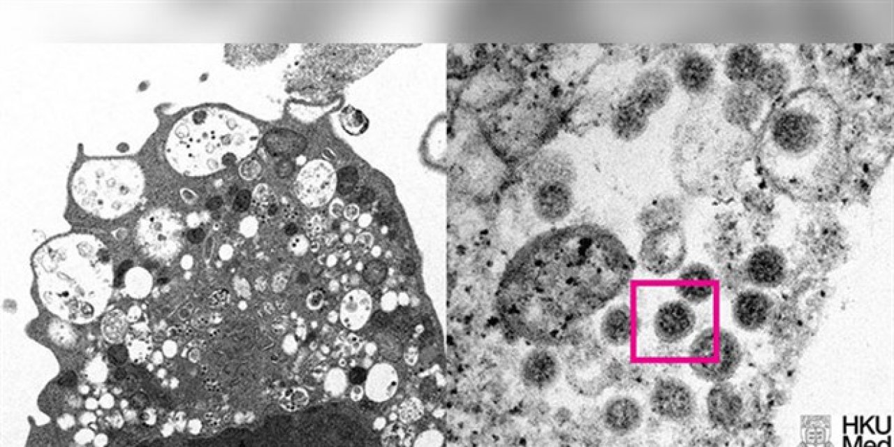 Omicron varyantının elektron mikroskobu görüntüsü yayınlandı