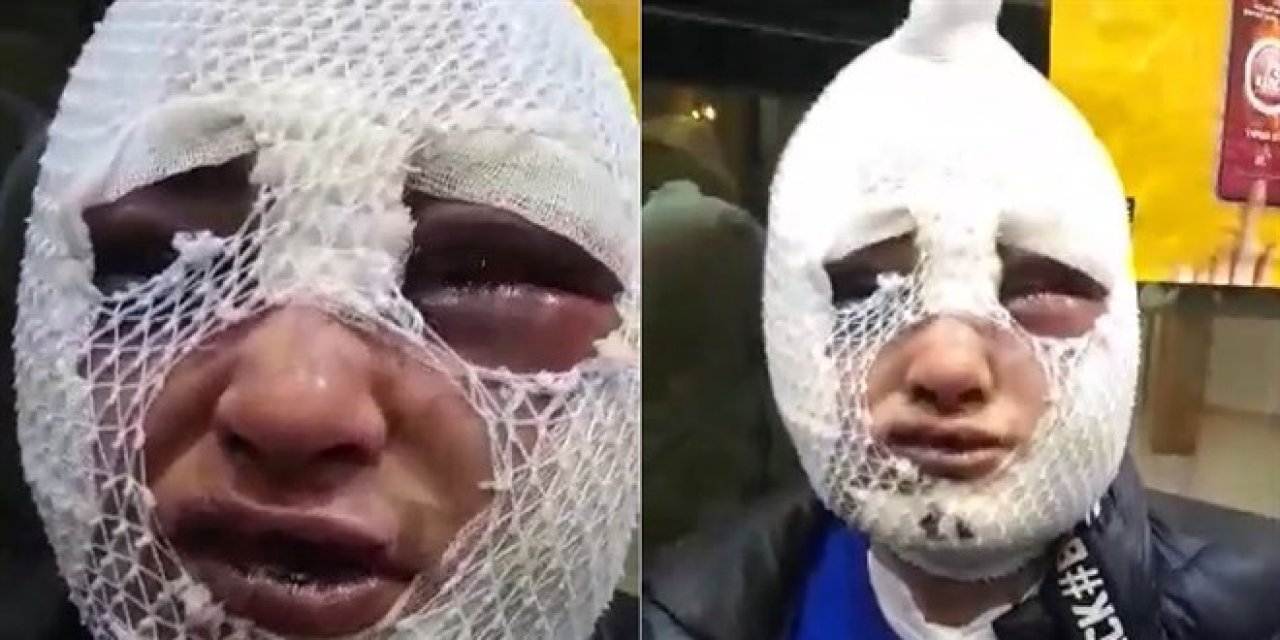 Evini basıp tecavüz etti sonra da başından aşağı kızgın yağ döktü