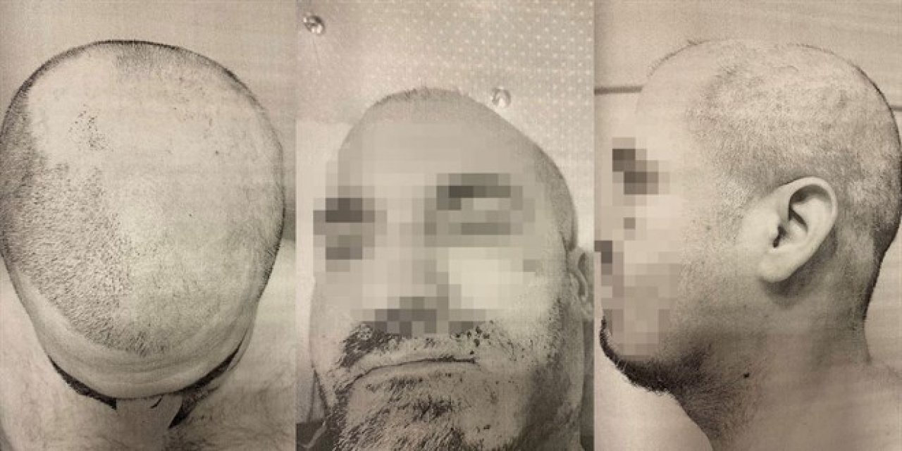 Öğrenci yurdunda işkence! Bağlayıp sakallarını ve saçlarını ağda ile söktüler