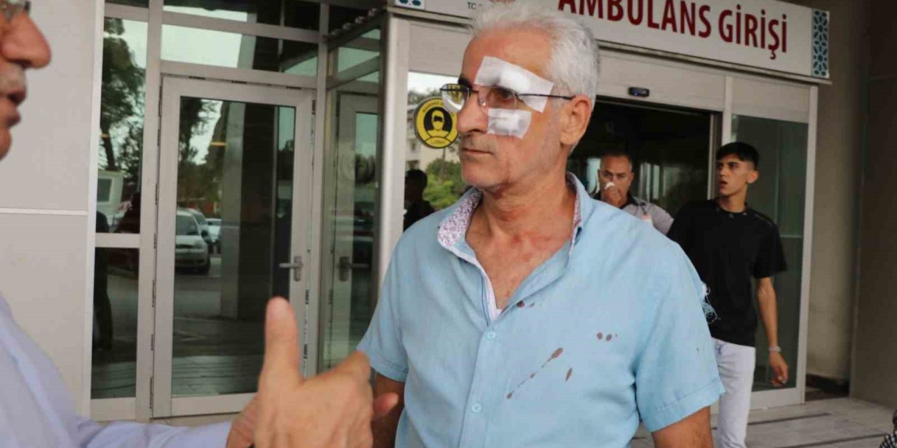 "Meslektaşımı dövmeyin" diyen öğretmen taksiciden dayak yed