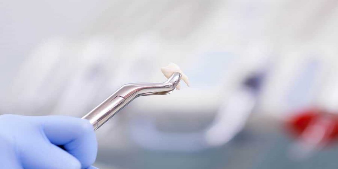 Hastaya Kızıp Dişlerini Çekti. Doktor Değil Temizlik Görevlisi Çıktı!