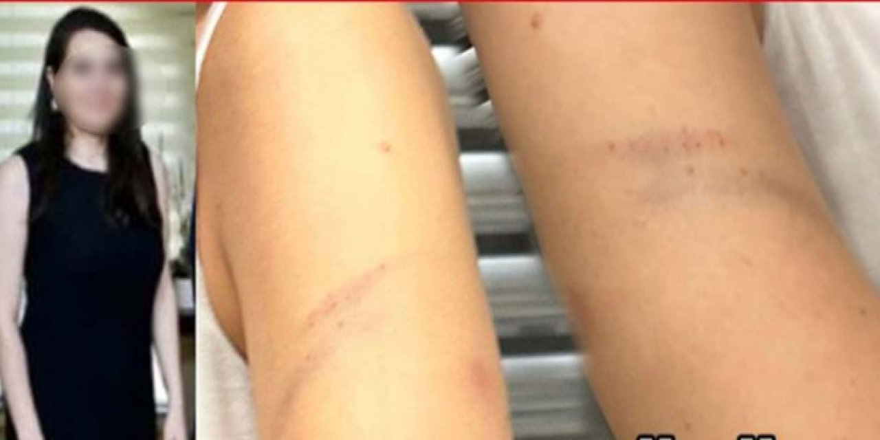 Kadın Müdür'den mobbing ve skandal dayak!