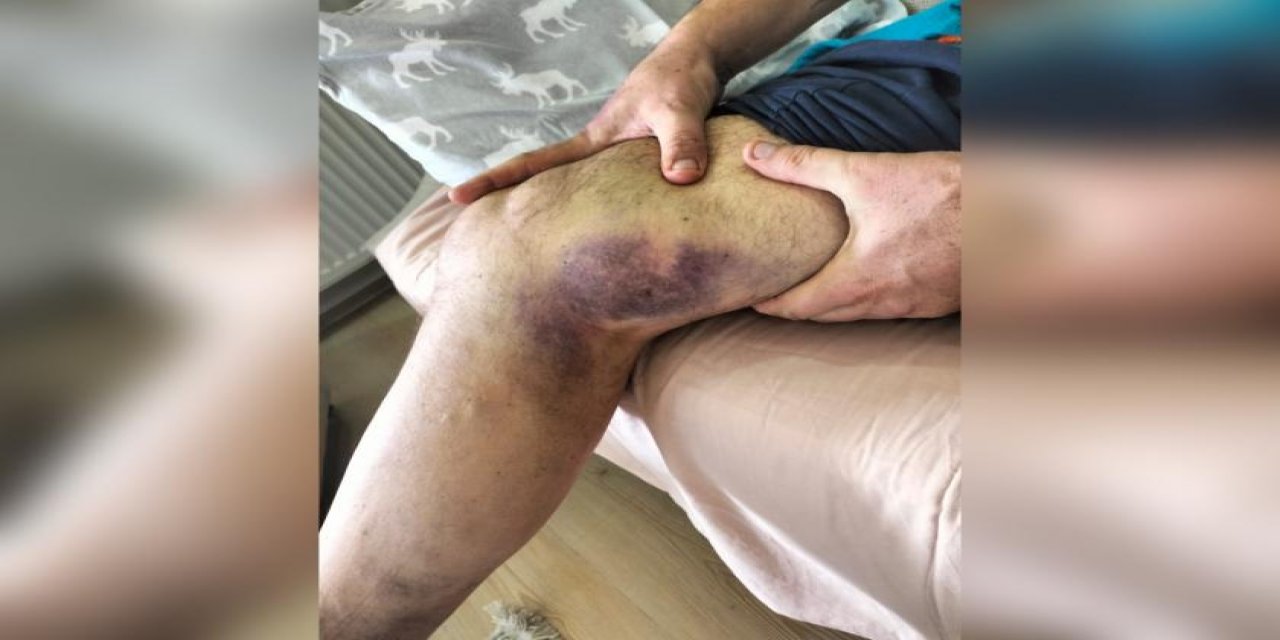 ''Öğretmen, Ak Parti İlçe Başkanı tarafından darp edildi'' iddiası