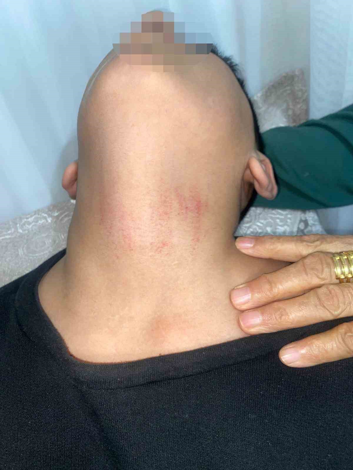 Kadın Okul Memuru 10 Yaşındaki Öğrencinin Boğazını Sıktı İddiası