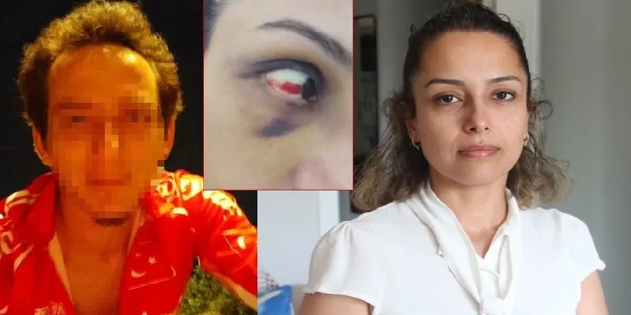 Boşanma Sürecindeki Burcu Öğretmen: "Darp Edildim, Tehdit Edildim!"