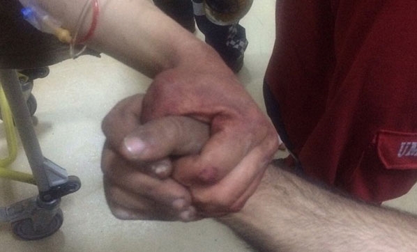 Yaralı askerlerin el ele tutuşması paylaşım rekorları kırıyor