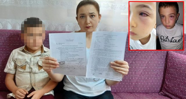 Çocuğuyla tartışan okul arkadaşını evine çağırıp yumrukla döverek hastanelik etti