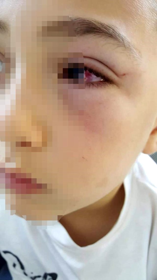 Çocuğuyla tartışan okul arkadaşını evine çağırıp yumrukla döverek hastanelik etti