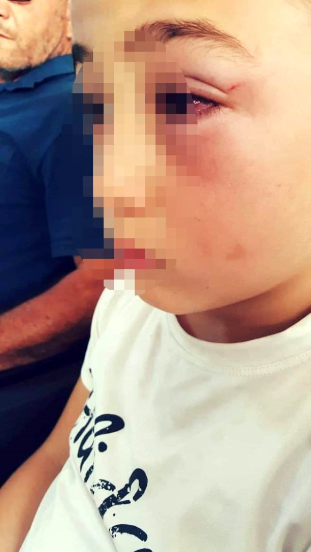 Çocuğuyla tartışan okul arkadaşını evine çağırıp yumrukla döverek hastanelik etti